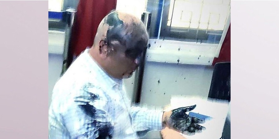 जनक शिक्षा सामग्री केन्द्रका प्रबन्ध निर्देशक अनिलकुमार झालाई कालोमोसो